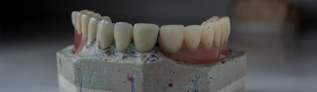 FC – Laser Dentistry at Buena Vida Dental Studio in Tucson AZ